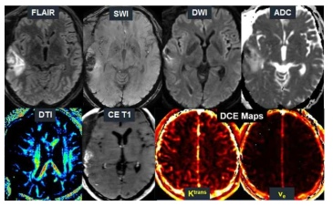 경도 TBI에 특화된 환자용 MRI 프로토콜