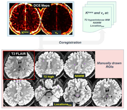 다양한 뇌영역별 DCE-MRI 정량 분석기법