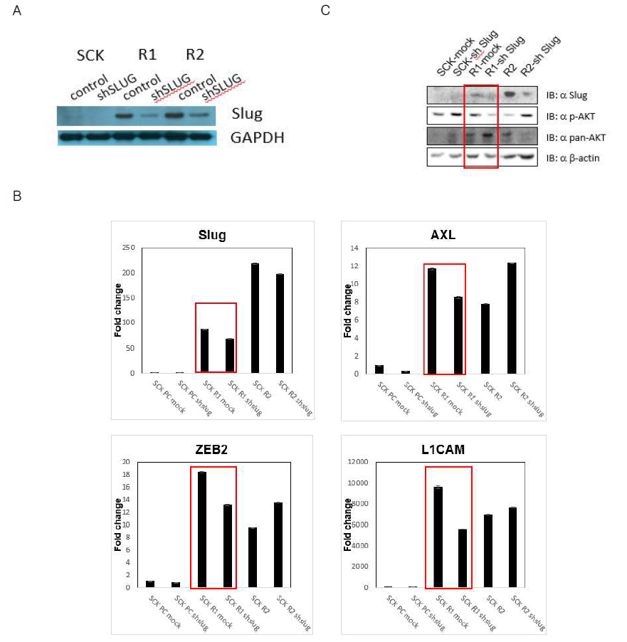 SLUG 발현 억제에 의한 SCK, SCK-R1 세포의 분자적 변화 분석 결과. (A) SLUG 발현이 knockdown된 SCK와 SCK-R1 세포의 웨스턴 블랏 분석 결과. (B) SLUG, ZEB2, L1CAM, AXL의 Realtime-PCR 분석 결과. (C) 신호분자 AKT의 웨스턴 블랏 분석 결과