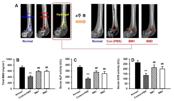 대퇴부 골 결손 부위의 생리활성 펩타이드-하이드로젤 복합지지체 주입에 따른 (A) micro-CT 이미지, (B) total BMD 정량, (C) 세럼내의 ALP 활성과 (D) 세럼내의 OCN 활성 비교