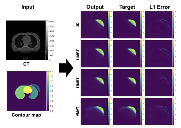 Dose map 예측 모델의 입력(input, CT와 contour map), 출력(output), 정답(target), 그리고 출력과 정답 사이의 차이(L1 error)