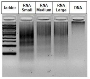 폴리머화된 DNA 및 RNA의 전기영동분석