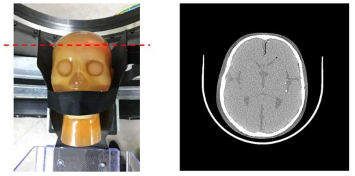 개발 시제품의 평가를 위한 Brain 팬텀 영상분석 연구