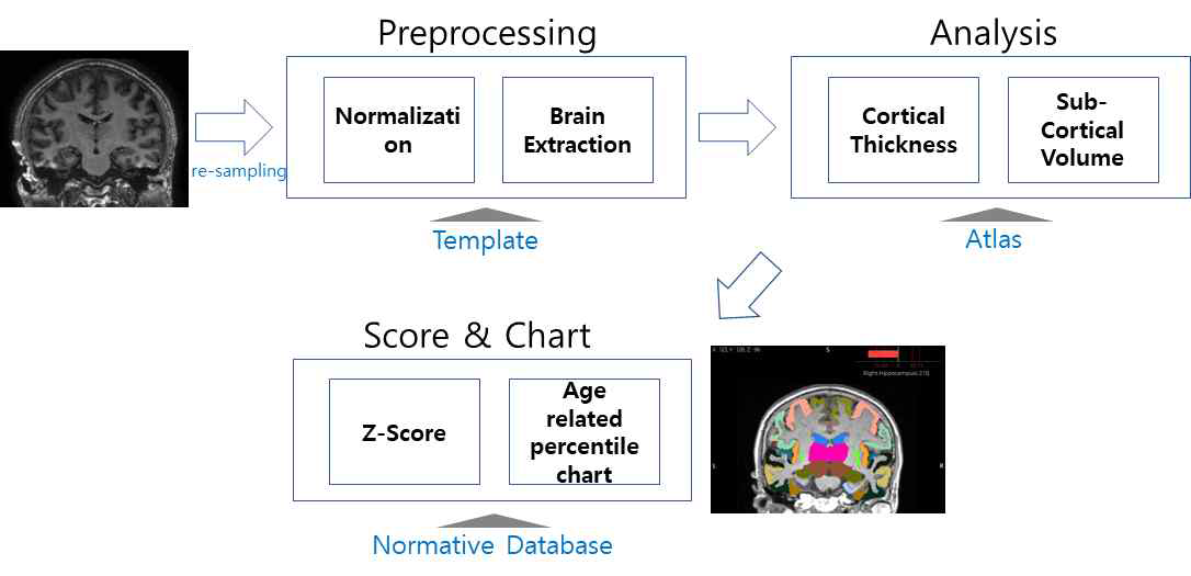 구조적 뇌 영상 분석 프로세스