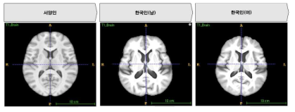 한국인과 서양인 뇌의 구조적인 차이