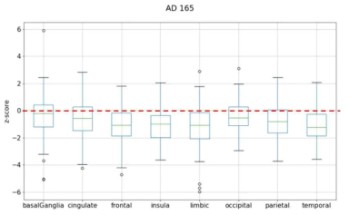 정상인 평균(빨간점선)을 기준으로 AD의 ROI 그룹별 z-score 분포