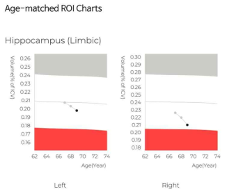 GAM 알고리즘으로 구현한 해마(Hippocampus)의 연령기반 차트