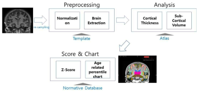구조적 뇌 영상 분석 프로세스