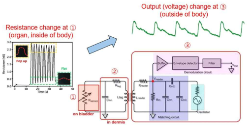 생체 내부의 strain 변화 측정 및 무선 신호 변환에 대한 모식도