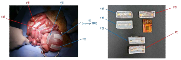 돼지 모델의 방광, 장기에 부착한 직후 및 7일 후 모델을 개복하여 꺼낸 다섯 개의 샘플