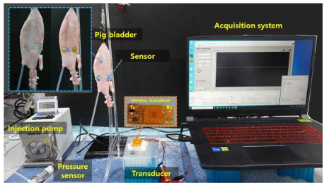 방광 맞춤형 시한성 3S 정량적 평가를 위한 in vitro 및 ex vivo 시스템