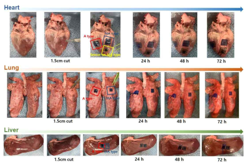 심장, 폐, 간 ex vivo 시스템을 이용한 시한성 3S 접착 소재의 성능 확인