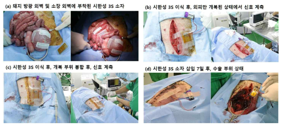 시한성 3S 성능 확인을 위한 대동물(돼지) in vivo 모델 확립 및 사전 실험