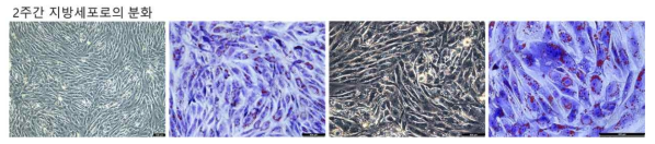 2D에서 2주간 지방 분화 유도 세포