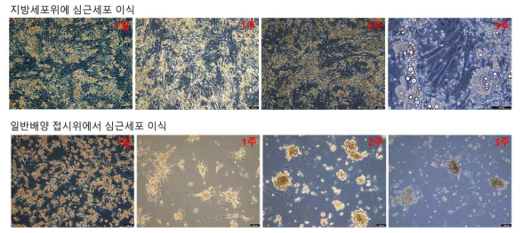 2D에서 형성된 지방세포 위에 심근세포를 이식하고 3주간 배양한 광학현미경 사진