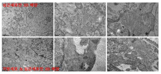 지방세포와 심근세포의 3D 공배양 구조체 3주차 TEM 이미지