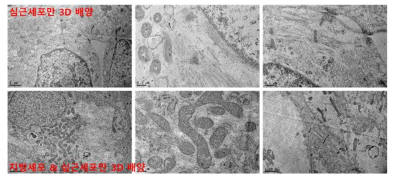 지방세포와 심근세포의 3D 공배양 구조체 5주차 TEM 이미지