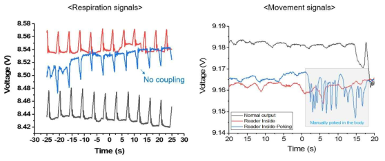 무선 소자를 통한 호흡 및 장기의 움직임 측정 결과