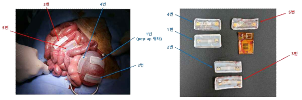 돼지 모델의 방광, 소장에 부착한 직후 및 7일 후 모델을 개복하여 꺼낸 다섯 개의 샘플