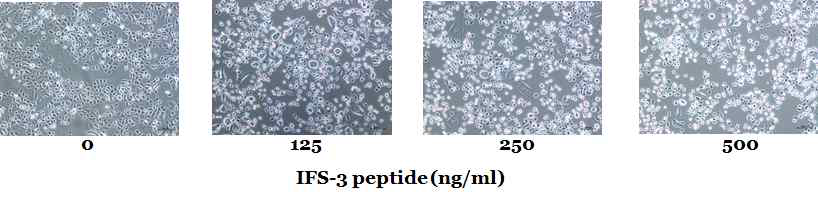 PYP1-2 처리 시 세포의 형태가 변하는 것을 확인하였다