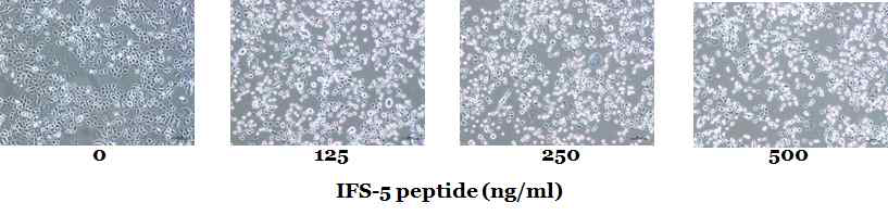 PYP1-7 처리 시, 세포형태가 변화하였다