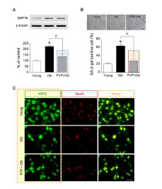 해마 신경세포의 노화에 따른 GRP78 발현 및 SA-beta-gal 활성 증가가 방사무뉘김 펩타이드에 의해 감소되었다. 특히, 해마 신경세포의 신경신호전달에 중요한 neurite의 퇴화(degeneration)를 지연시켰다