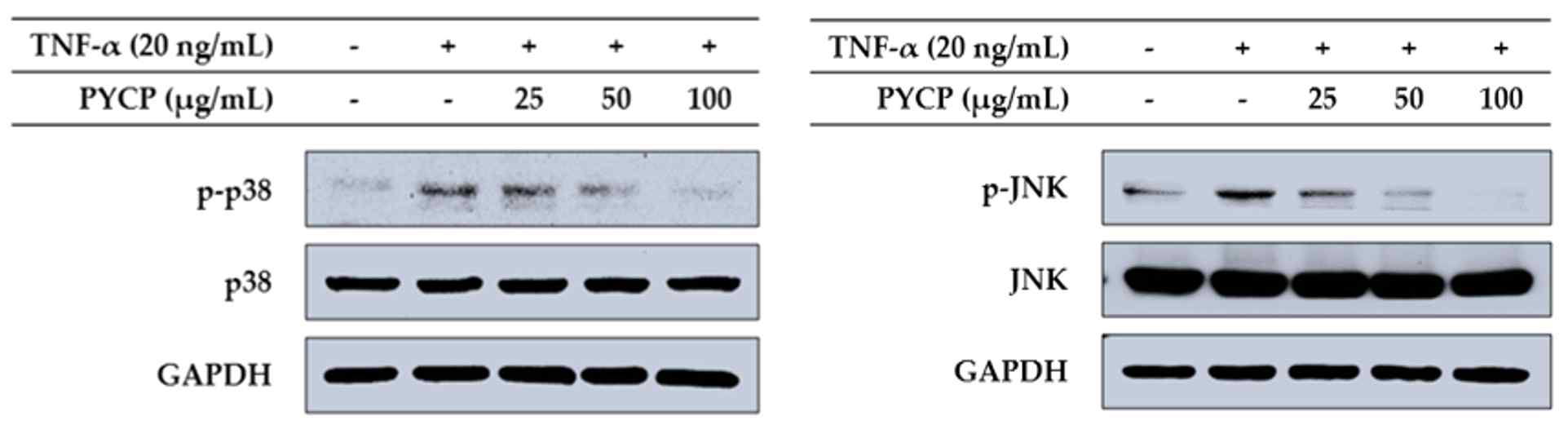 TNF-α에 의해 증가된 p38 및 JNK의 인산화 수준이 방사무늬김 단백질의 처리에 의해 감소하였다