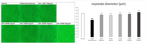 유단백가수분해물과 LDIQK의 처리에 따른 근관세포의 현미경사진 (x400) 및 근관세포 두께 증가