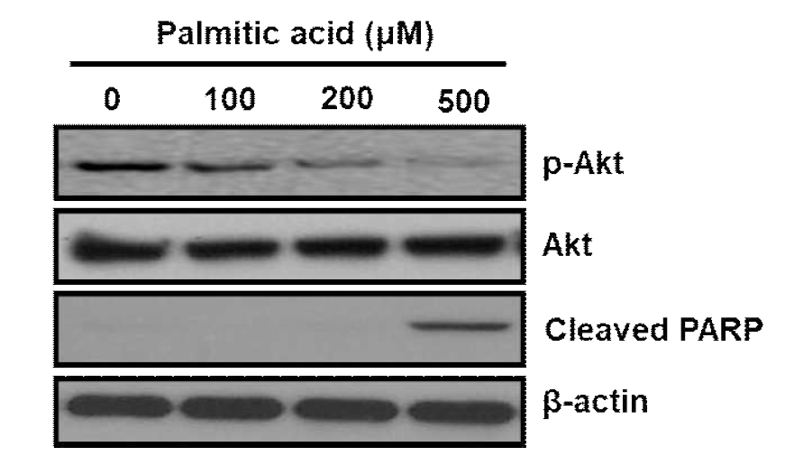 Adiponectin의 palmitate 지방산 유도 세포사멸 및 독성에 대한 효과