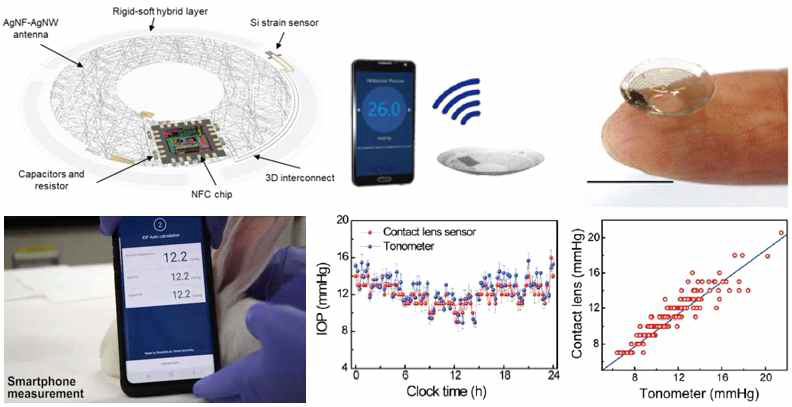 실시간 무선 송수신이 가능한 안압 모니터링용 스마트 콘택트렌즈 제작 기술개발