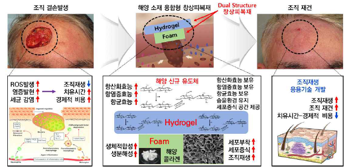 해양 신규 유도체 및 해양 콜라겐 융합형 조직재생용 2중층 창상피복재 조직 재건 예시