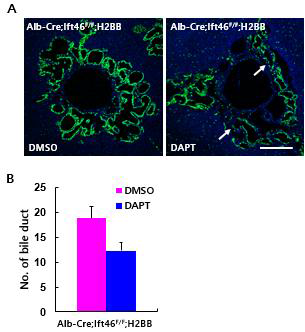 간세포특이 Ift46 결핍 마우스에서 DAPT 처리에 의한 담소관 증식 감소. (A) 담관 표지 H2BB (B) 담관의 수 분석