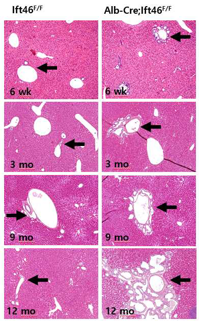 간세포특이 Ift46 결핍 마우스에서 담소관 증식 현상 (화살표; 담관)