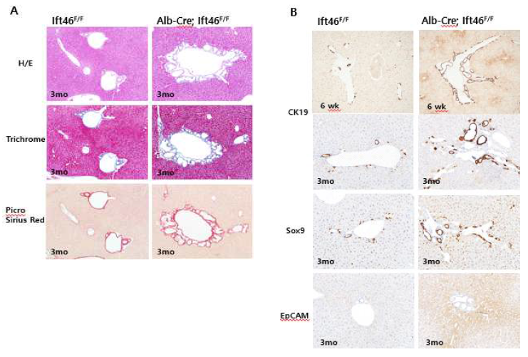 간세포특이 Ift46 결핍 마우스의 담관에서 collagen 축적(A)과 담관상피세포 표지인자 분석 (B). Masson’s trichrome 염색 (파란색). Picro Sirius red 염색 (적색)/ CK19, Sox9, EpCAM 면역 염색 (갈색)
