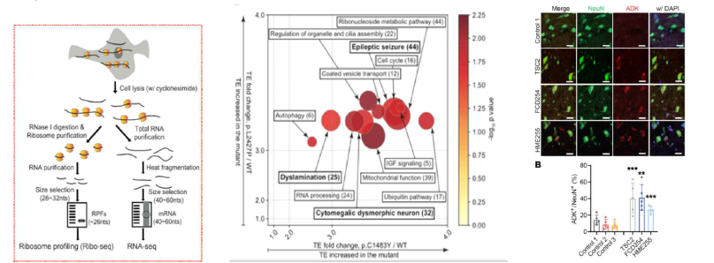 (왼쪽 패널) Ribosome profiling 실험의 개념 모식도, (가운데 패널) MTOR 뇌 체성 돌연변이에 의해 translation이 증가된다고 밝혀진 256개 유전자에 대한 기능적 분류 결과, (오른쪽 패널) MTOR 뇌 체성 돌연변이를 가 진 난치성 환자 뇌조직에서 대조군 환자 뇌조직에 비해 ADK 발현 상당히 증가됨을 보여주는 IHC 결과