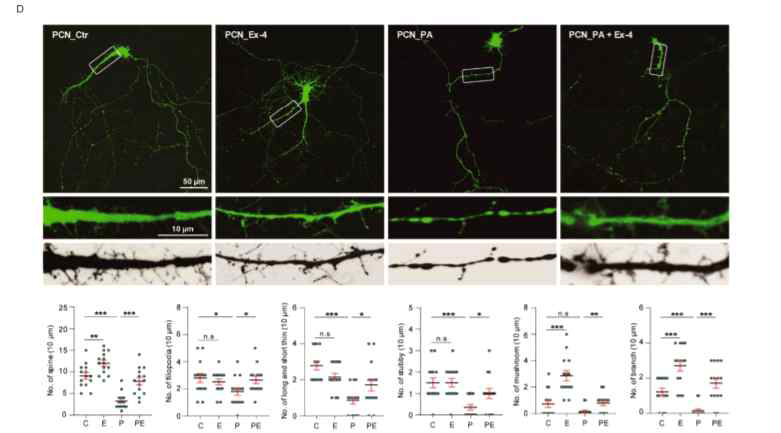 Exendin-4 improved the synaptic plasticity under palmitic acid-induced oxidative stress