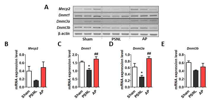 전전두엽에서 DNA 메틸화 프로세스와 관련된 유전 자들의 mRNA 발현수준 변화. *p < 0.05 vs Sham, ##p < 0.01 vs PSNL