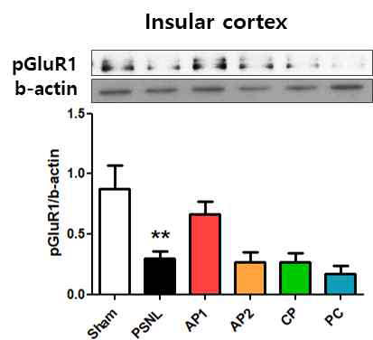 PSNL모델의 Insular cortex에서 글루타메이트 수용체 에 대한 침의 효과