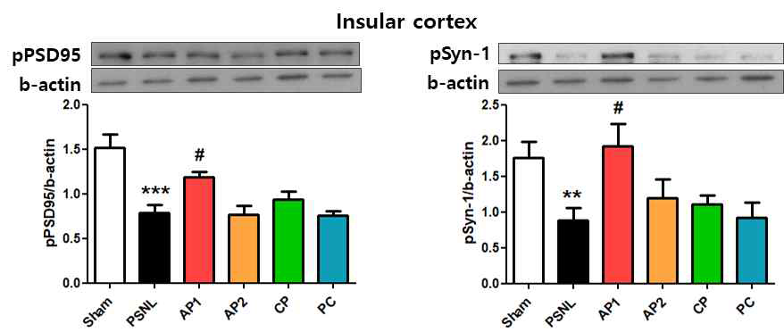 PSNL모델의 Insular cortex에서 synaptic protein에 대한 침의 효과