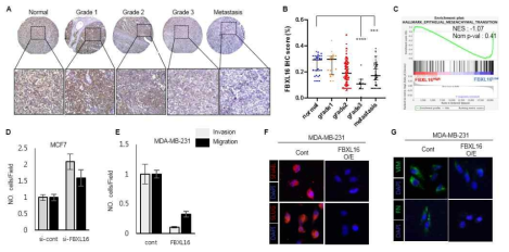 FBXL16 매개 유방암 종양악성화 억제 기전 규명
