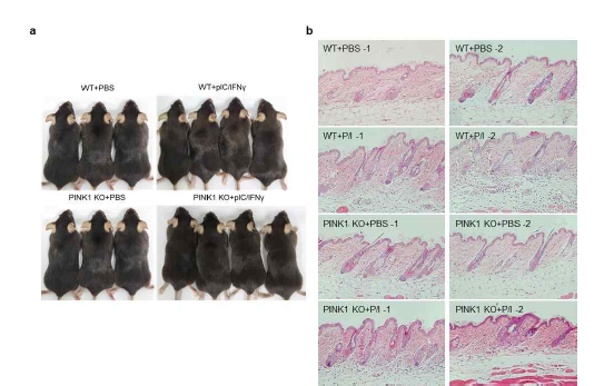 PINK1 knockout mice에 염증 반응에 따른 원형탈모 유도 실험