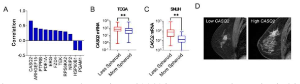 (A) TCGA data set의 CASQ2와 SED 상관관계분석. (B) CGA data set의 CASQ2의 종양모양별 CASQ2 mRNA 발현분석.(C) SNUH 환자의 CASQ2 종양모양별 CASQ2 mRNA 발현분석. (D) 환자의 종양모양 자기공명영상분석