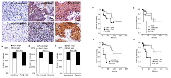 피부편평세포암 환자 조직에서 Axin2 및 Snail의 단백질 발현 (좌) 및 임상적 유효성 평가 (우)