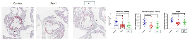 Fer-1 및 compound #1의 동맥경화 억제 효능(두 약물 모두 1 mg/kg, daily)