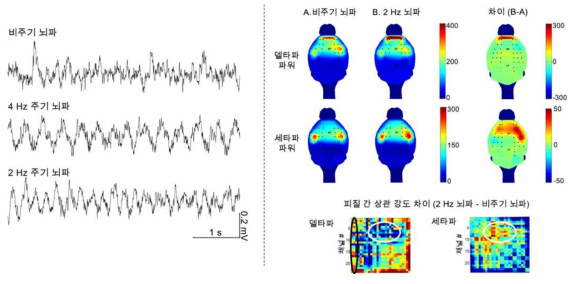 (좌) 주기성 없는 뇌파 및 2 Hz, 4 Hz 주기성을 보이는 뇌파 예시, (우) 비주기 뇌파와 2 Hz 주기성 뇌파의 델타파 및 세타파의 파워 토포맵과 피질 영역 간 상관성