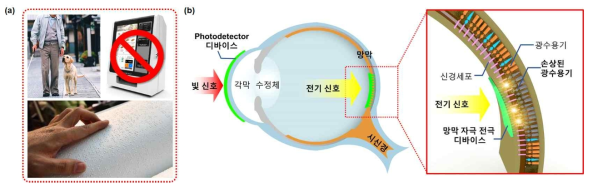 (a) 시각 장애인이 겪는 불편함 (b) 전자망막 기술의 개념도