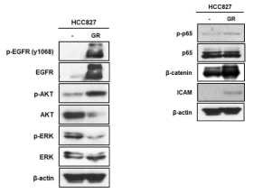 HCC827 과 HCC827/GR 세포주에서의 각종 세포내 신호전달 물질의 차이확인