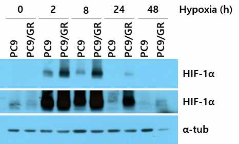 EGFR-TKI 내성 세포주 (PC9/GR)와 감수성 세포주(PC9)의 HIF-1α 발현 비교