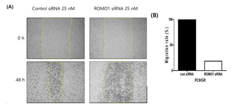 Comparison of PC9 cell migration activity with or without ROMO1 knockdown via an in vitro wound healing assay. (A) Time-lapse microscopic images of wound closure of PC9/GR cells transfected with control siRNA (left panel) and ROMO1 siRNA (right panels) at 0 and 48 h after scratching. (B) The percentage of the total area covered by the cells was assessed using the National Institutes of Health (NIH) Image program. The migration rate decreased by approximately 78.2% in PC9 cells transfected with ROMO1 siRNA than in control PC9 cells