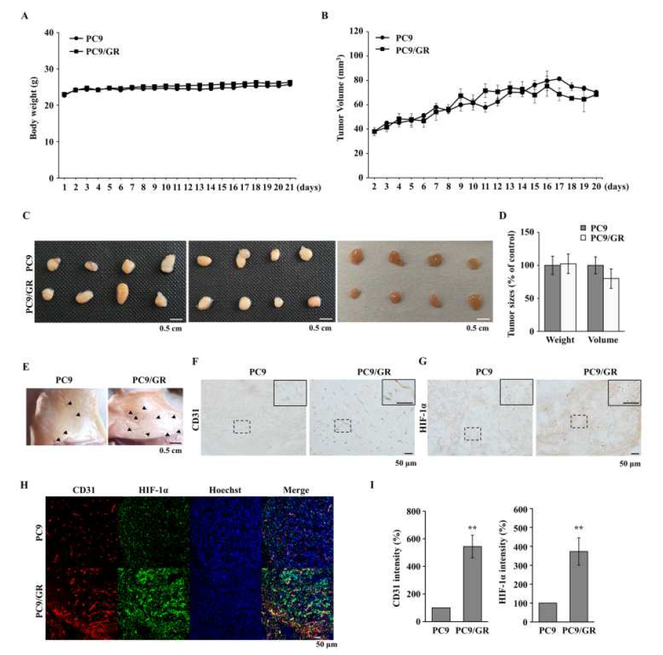 PC9 and PC9/GR tumors were generated in BALB/c nude mice and tumor 혈관신생 was increased in PC9/GR tumors. BALB/c nude mice were injected with PC9 cells or PC9/GR cells, then (A) mouse weight and (B) tumor volume were measured using a digital balance and vernier caliper, respectively, every day for 3 weeks. (C) The mice were sacrificed, 3 weeks after the injection of the PC9 or PC9/GR cells and the tumors were isolated and images were captured, and (D) tumor volume and weight were measured. The data are presented as the mean ± SEM of 3 independent experiments with 4 mice per group (total 12 mice per group). (E) Blood vessels under the skin adjacent to the tumor tissues were examined. Arrowheads indicate visible blood vessels. Tumor sections were immunostained with specific antibodies for (F) CD31 and (G) HIF‑1α. The squares with full black lines are the 2‑fold magnified images for the dotted squares. (H) Double immunofluorescence staining was performed using specific antibodies against HIF‑1α and CD31. Nuclei were stained with Hoechst 33342. (I) Signals for HIF‑1α and CD31 were quantified using ImageJ software. The data are presented as the mean ± SEM from 3 independent experiments. **P<0.01 vs. PC9 tumors